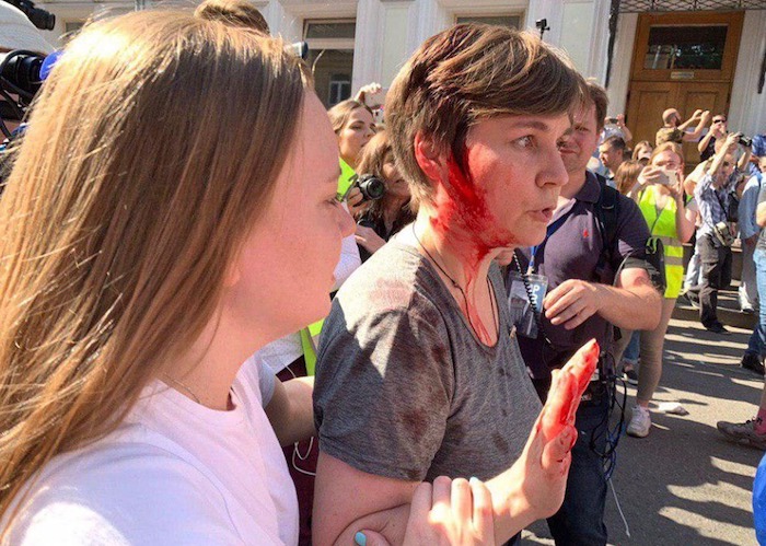На митинге оппозиции в Москве муниципальному депутату района Хамовники разбили голову